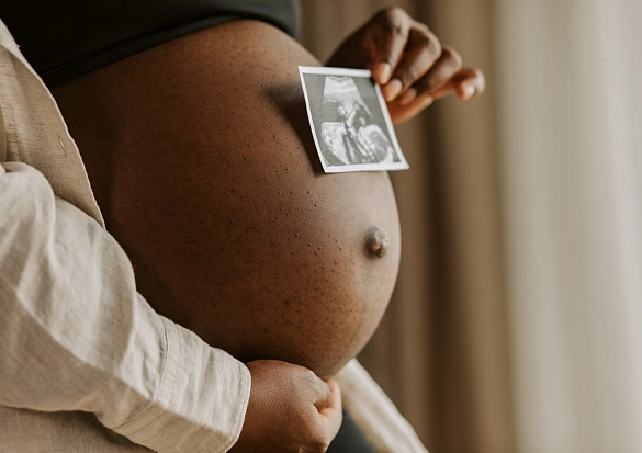 Schwangere hält sich den Bauch